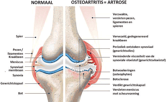 Gewrichtsdeel